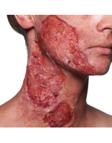 Artex Kryolan.